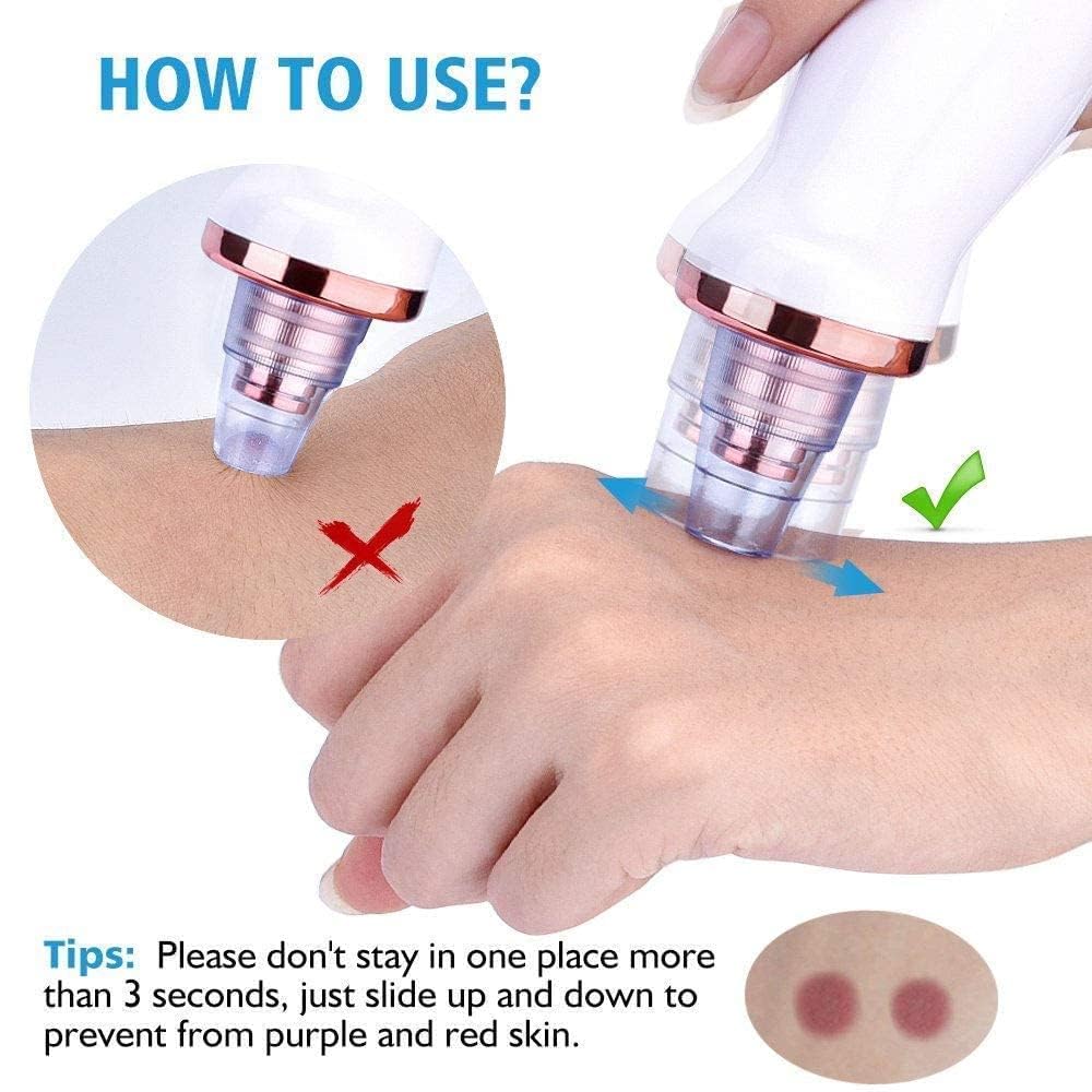 Blackhead Remover Tools | Electric Derma suction Machine | USB Rechargeable Acne Pimple Pore Cleaner Vacuum tool | Facial Cleanser Device for Nose & Skin Care