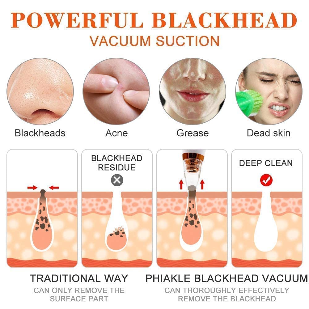 Blackhead Remover Tools | Electric Derma suction Machine | USB Rechargeable Acne Pimple Pore Cleaner Vacuum tool | Facial Cleanser Device for Nose & Skin Care